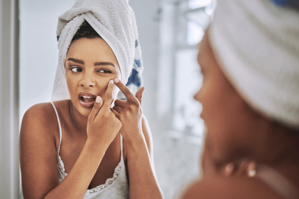 mineral makeup for acne prone skin 